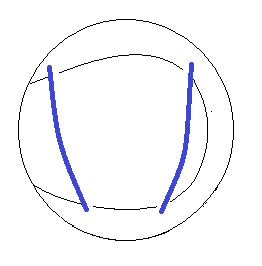 スプリット.png